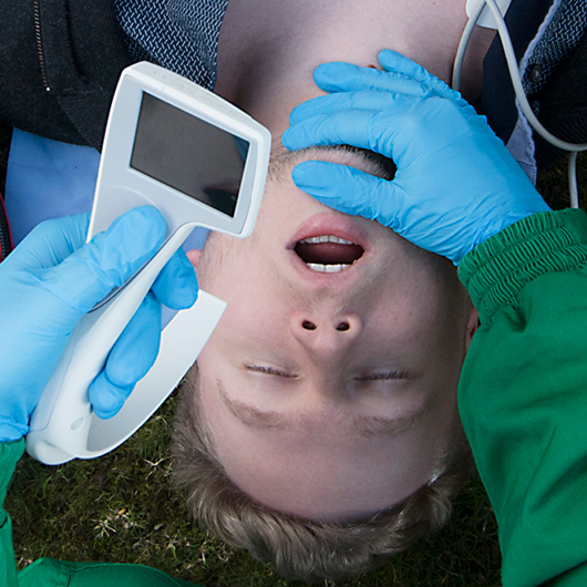 Universal Video Laryngoscopy (UVL)