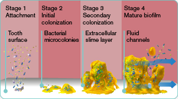 The complete Oral Care Programme for ICU - toothbrushes, mouthwashes ...